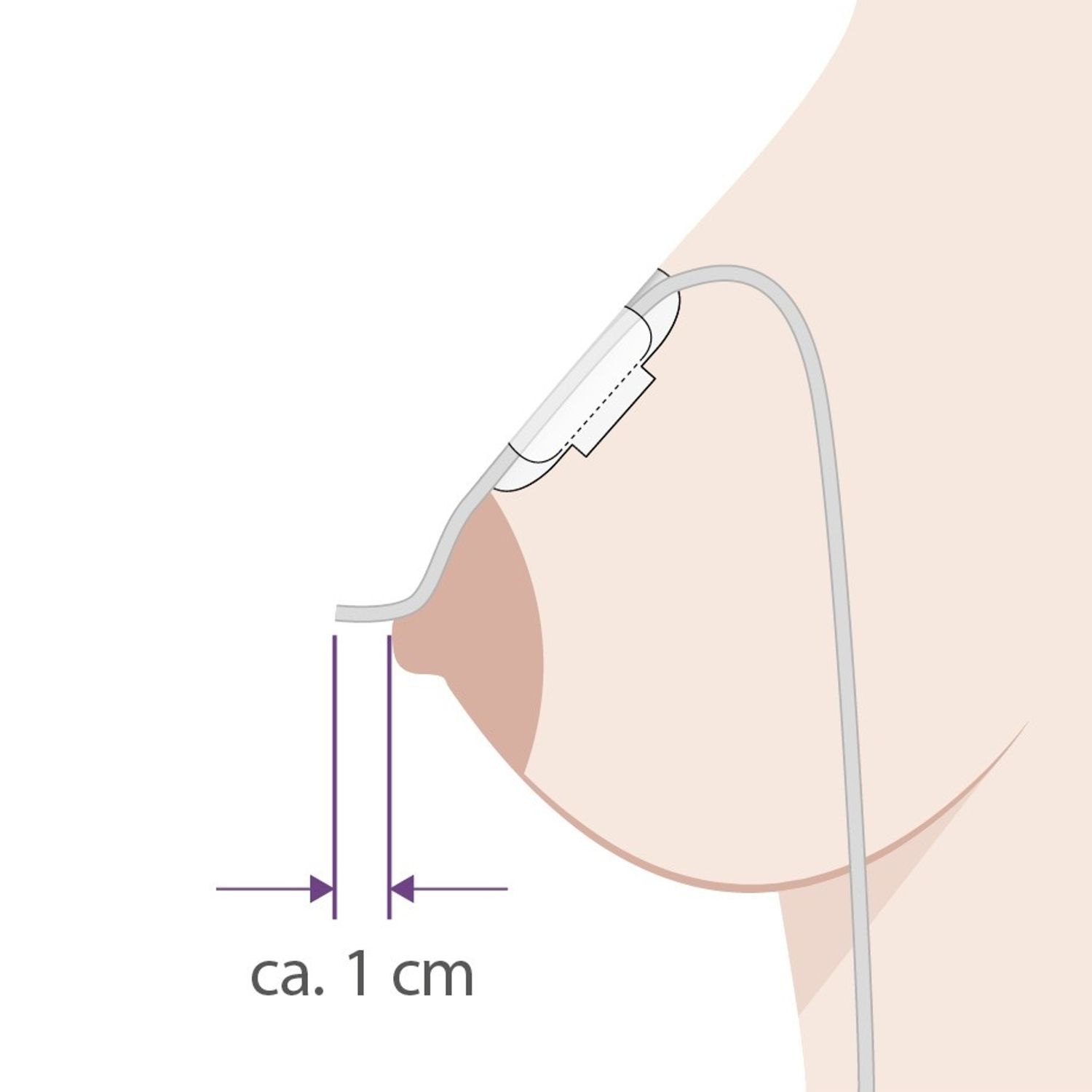 ENFit Sonde zum Brust Zufüttern mit Pflaster 40cm